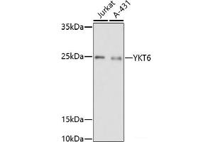 Western blot analysis of extracts of various cell lines using YKT6 Polyclonal Antibody at dilution of 1:1000.