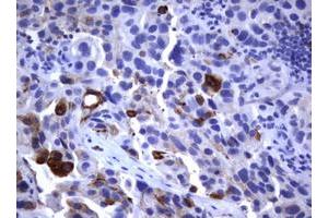 Image no. 1 for anti-Fc Fragment of IgE, Low Affinity II, Receptor For (CD23) (FCER2) (AA 48-321) antibody (ABIN1491554) (FCER2 Antikörper  (AA 48-321))