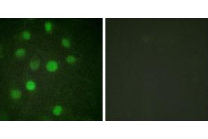 serum + -Immunofluorescence analysis of HuvEc cells, treated with serum (20%, 15mins), using Histone H1 (Ab-17) antibody. (Histone H1 Antikörper)