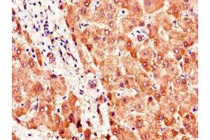 Immunohistochemistry of paraffin-embedded human liver tissue using ABIN7169898 at dilution of 1:100 (SMO Antikörper  (AA 28-233))