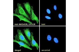 (ABIN185658) Immunofluorescence analysis of paraformaldehyde fixed HeLa cells, permeabilized with 0. (GRIN2B Antikörper  (Internal Region))