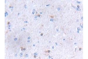 Detection of GLTP in Human Cerebrum Tissue using Polyclonal Antibody to Glycolipid Transfer Protein (GLTP) (GLTP Antikörper  (AA 2-209))