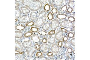Immunohistochemistry of paraffin-embedded rat kidney using DC Rabbit mAb (ABIN7266685) at dilution of 1:200 (40x lens). (DCAF7 Antikörper)