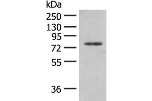 Western blot analysis of Hela cell lysate using TRMT1 Polyclonal Antibody at dilution of 1:300 (TRMT1 Antikörper)