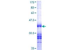 PTGER4 Protein (AA 379-488) (GST tag)