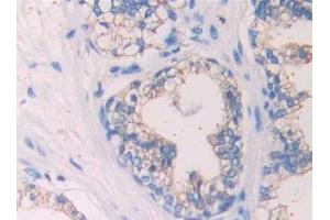 Immunohistochemistry (IHC) image for anti-Single Immunoglobulin and Toll-Interleukin 1 Receptor (TIR) Domain (SIGIRR) (AA 1-118) antibody (ABIN7437203)