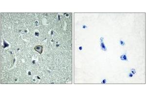 Immunohistochemistry analysis of paraffin-embedded human brain tissue, using BAI2 Antibody. (BAI2 Antikörper  (AA 91-140))