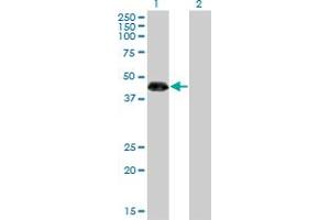 Western Blot analysis of ZNF3 expression in transfected 293T cell line by ZNF3 monoclonal antibody (M08), clone 1F7. (ZNF3 Antikörper  (AA 1-110))