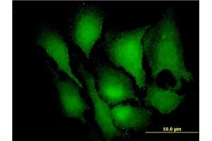 Immunofluorescence of monoclonal antibody to MAPK3 on HeLa cell.