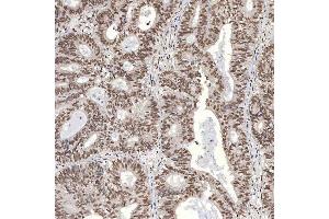 IHC analysis of U1A/SNRPA using anti-U1A/SNRPA antibody (ABIN7600891). (SNRPA1 Antikörper  (AA 25-218))