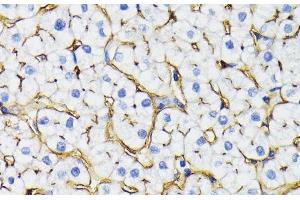 Immunohistochemistry of paraffin-embedded Human liver using NT5E / CD73 Polyclonal Antibody at dilution of 1:200 (40x lens). (CD73 Antikörper)