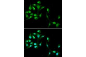 Immunofluorescence analysis of A549 cell using HEXIM1 antibody.