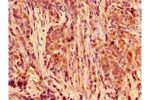Immunohistochemistry (IHC) image for anti-Polymerase (RNA) II (DNA Directed) Polypeptide C, 33kDa (POLR2C) (AA 2-275) antibody (ABIN7150430)
