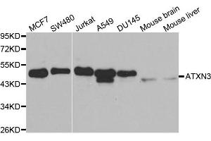 Western blot analysis of extracts of various cell lines, using ATXN3 antibody. (Ataxin 3 Antikörper  (AA 1-364))