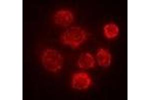 Immunofluorescent analysis of SBP-2 staining in Hela cells. (SECISBP2 Antikörper)