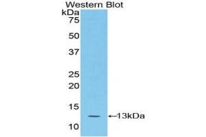 Detection of Recombinant S100A4, Mouse using Polyclonal Antibody to S100 Calcium Binding Protein A4 (S100A4) (s100a4 Antikörper  (AA 1-101))