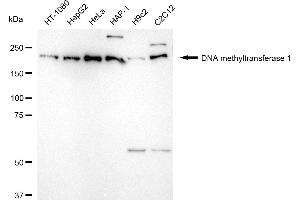 Western blotting analysis using DNA methyltransferase 1 antibody (ABIN7798362). (Rekombinanter DNMT1 Antikörper)