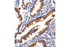 Immunohistochemical analysis of paraffin-embedded H. (SHB Antikörper  (AA 250-290))