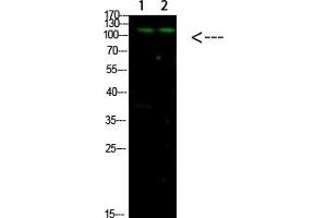 Western Blot analysis of 1, Mouse-liver 2, hela cells using primary antibody diluted at 1:1000 (4 °C overnight). (GLI1 Antikörper  (AA 460-490))