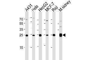Western blot analysis of lysates from A431, Hela, HepG2, MCF-7, Raji cell line and mouse kidney tissue lysate (from left to right), using AK4 Antibody (Center) (ABIN1944856 and ABIN2838526).