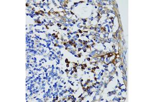 Immunohistochemistry of paraffin-embedded human tonsil using USO1 antibody (ABIN1875291) at dilution of 1:100 (40x lens). (USO1 Antikörper)