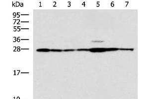 Western blot analysis of Rat liver tissue Mouse kidney tissue Mouse lung tissue HUVEC Jurkat Hela HepG2 cell lysates using RPL10A Polyclonal Antibody at dilution of 1:700