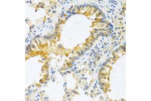 Immunohistochemistry of paraffin-embedded mouse lung using IL20 antibody at dilution of 1:100 (40x lens). (IL-20 Antikörper)