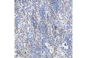 Immunohistochemistry (IHC) image for anti-Suppressor of Cytokine Signaling 1 (SOCS1) (AA 1-211) antibody (ABIN6148263)