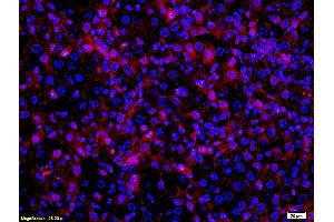 Formalin-fixed and paraffin embedded mouse melanoma labeled with Anti- MITF Polyclonal Antibody, Unconjugated (ABIN676373) at 1:200 followed by conjugation to the secondary antibody Goat Anti-Rabbit IgG, PE conjugated used at 1:200 dilution for 40 minutes at 37°C and DAPI (MITF Antikörper  (AA 351-450))