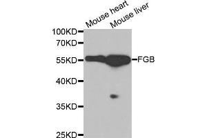 Western blot analysis of extracts of various tissues, using FGB antibody. (Fibrinogen beta Chain Antikörper  (AA 202-491))