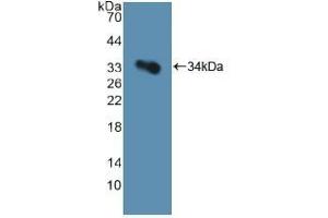 Detection of Recombinant GP1Ba, Human using Polyclonal Antibody to Cluster Of Differentiation 42b (CD42b) (CD42b Antikörper  (AA 19-291))