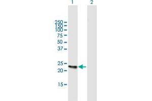 Western Blot analysis of KLK2 expression in transfected 293T cell line by KLK2 MaxPab polyclonal antibody.