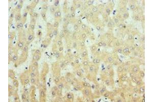 Immunohistochemistry of paraffin-embedded human liver tissue using ABIN7156335 at dilution of 1:100 (IRS1 Antikörper  (AA 1-160))