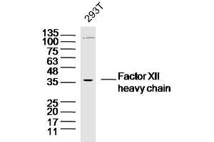 Human 293T cells probed with Factor XII heavy chain Polyclonal Antibody, unconjugated  at 1:300 overnight at 4°C followed by a conjugated secondary antibody at 1:10000 for 90 minutes at 37°C. (Factor 12 Heavy Chain (F12) Antikörper)