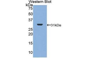 Western Blotting (WB) image for anti-DNA Topoisomerase II (TOP2) (AA 749-987) antibody (ABIN1860830) (TOP2 Antikörper  (AA 749-987))