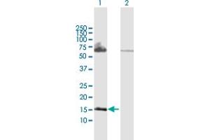 Western Blot analysis of PPP3R2 expression in transfected 293T cell line by PPP3R2 MaxPab polyclonal antibody.