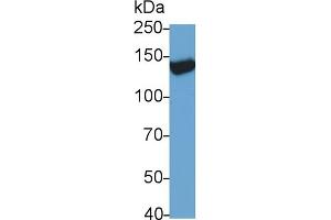 Detection of TRPM4 in Rat Serum using Monoclonal Antibody to Transient Receptor Potential Cation Channel Subfamily M, Member 4 (TRPM4) (TRPM4 Antikörper  (AA 1-400))