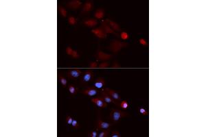 Immunofluorescence analysis of U2OS cells using SNRPE antibody (ABIN5973198). (SNRPE Antikörper)