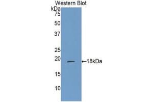 Western blot analysis of the recombinant protein. (ALOX15 Antikörper  (AA 170-312))