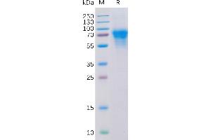 SDS-PAGE (SDS) image for CD46 (CD46) (AA 35-328) protein (His tag) (ABIN6964079)
