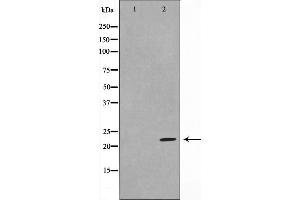 Western blot analysis on HeLa cell lysate using DIRA1 Antibody,The lane on the left is treated with the antigen-specific peptide. (DIRAS1 Antikörper  (C-Term))