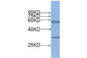 Western blot analysis of OsMADS14 protein expression in rice (CV. (MADS14 Antikörper)