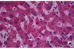 Immunohistochemistry (Formalin-fixed Paraffin-embedded Sections) (IHC (fp)) image for anti-Protein Phosphatase, Mg2+/Mn2+ Dependent, 1A (PPM1A) (AA 1-383) antibody (ABIN790507)