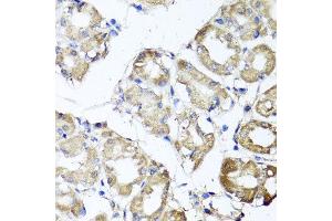 Immunohistochemistry of paraffin-embedded human gastric using MGAT1 antibody at dilution of 1:100 (x40 lens).