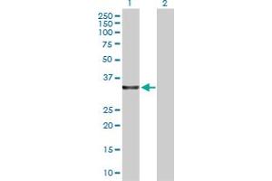 Western Blot analysis of LDHA expression in transfected 293T cell line by LDHA MaxPab polyclonal antibody. (Lactate Dehydrogenase A Antikörper  (AA 1-332))