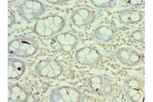 Immunohistochemistry of paraffin-embedded human colon tissue using ABIN7160218 at dilution of 1:100 (MORF4L1 Antikörper  (AA 1-100))