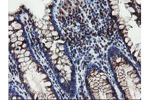 Immunohistochemical staining of paraffin-embedded Human colon tissue using anti-DPH2 mouse monoclonal antibody.