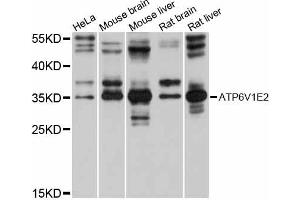 Western blot analysis of extracts of various cell lines, using ATP6V1E2 antibody (ABIN6292784) at 1:1000 dilution. (ATP6V1E2 Antikörper)