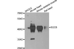 Western blot analysis of extracts of various cell lines, using SGCB antibody. (SGCB Antikörper)