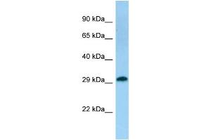 Host: Rabbit Target Name: TACO1 Sample Type: Fetal Kidney lysates Antibody Dilution: 1. (TACO1 Antikörper  (C-Term))